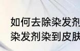 如何去除染发剂染在皮肤上的颜色 被染发剂染到皮肤如何处理